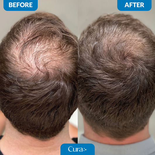 Cura Natural Hair Growth Serum