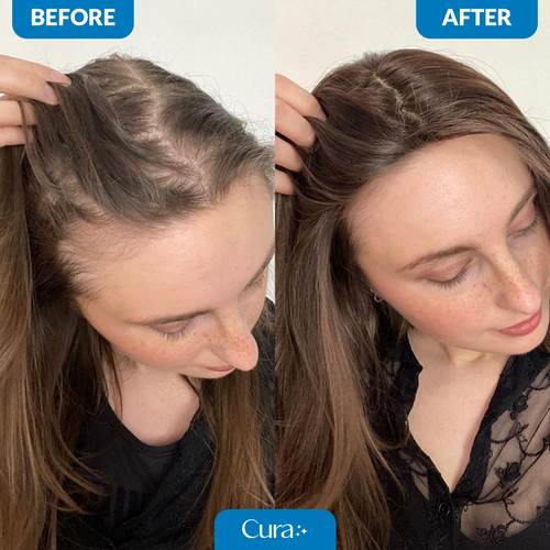 Cura Natural Hair Growth Serum